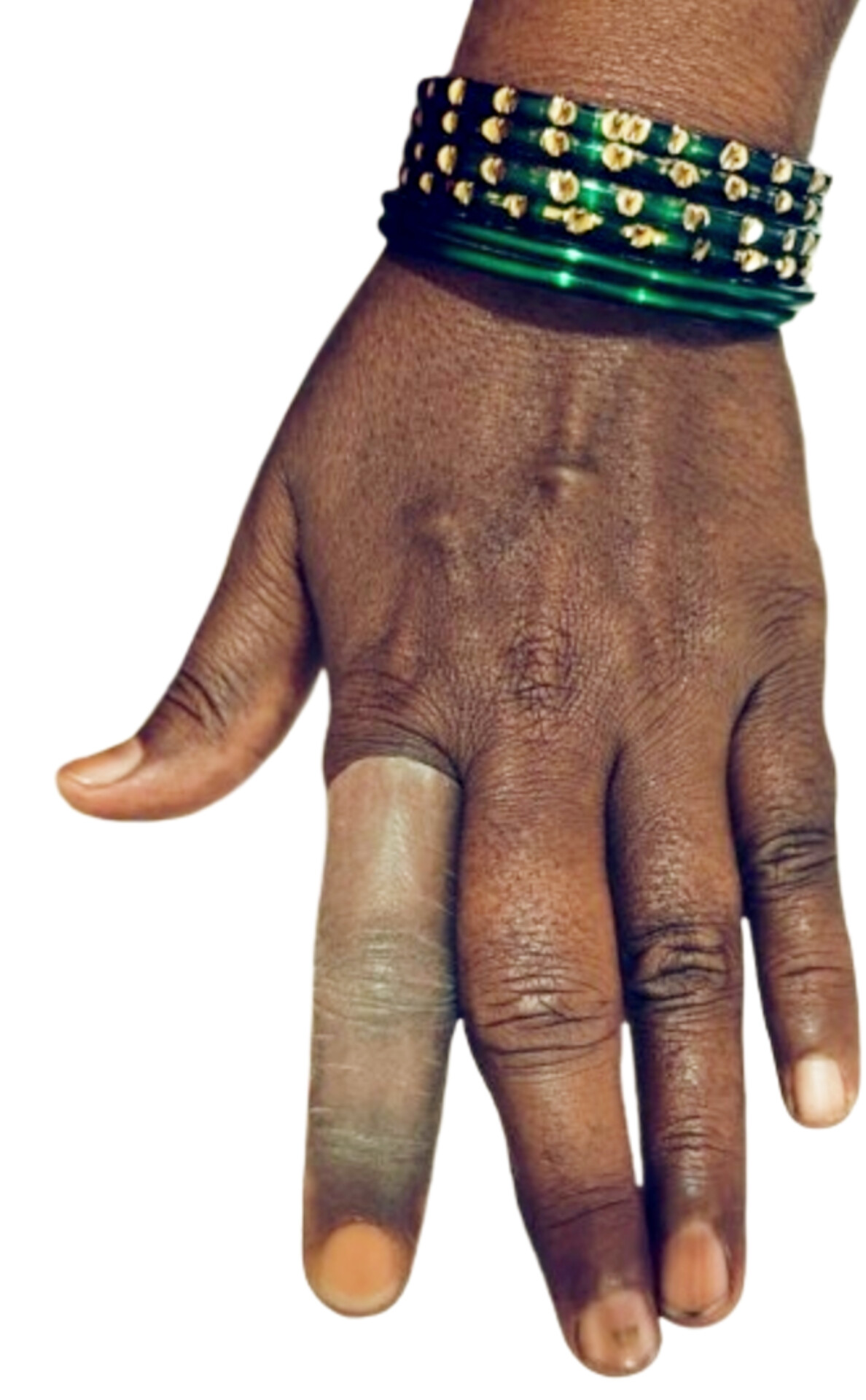 Image of Cosmatic Finger Restoration