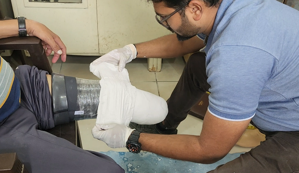 Creating a plaster cast