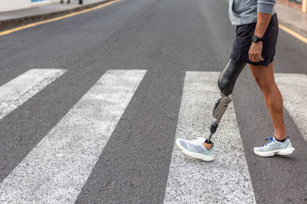 Image of a person crossing the road using prosthetic leg