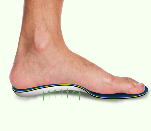 Image of Leg with arch support