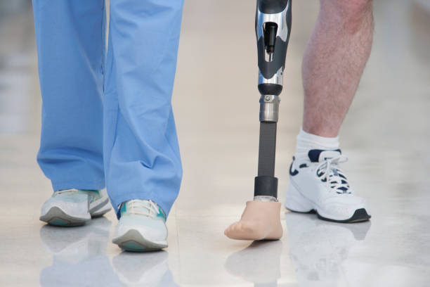 Image of a patient standing with a prosthetic leg